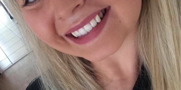 Depois do clareamento dental — caso 3